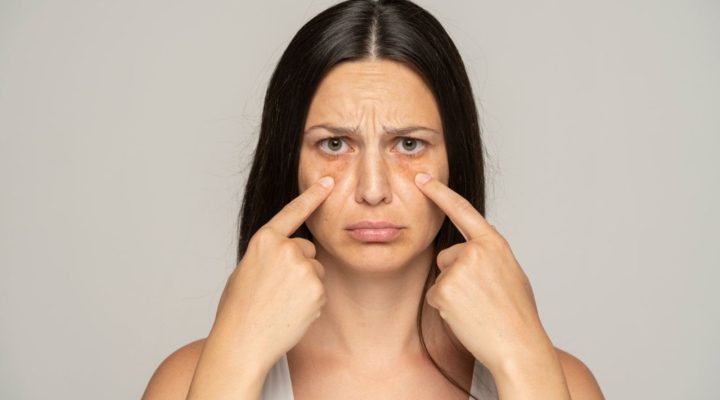 Femme montrant ses cernes sous les yeux avec une expression préoccupée